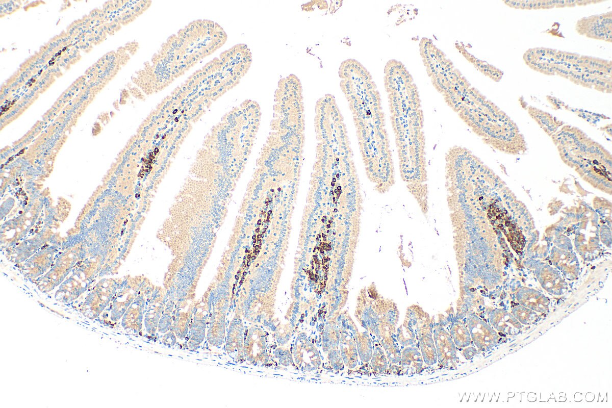 Immunohistochemistry (IHC) staining of mouse small intestine tissue using CLN3 Polyclonal antibody (20386-1-AP)