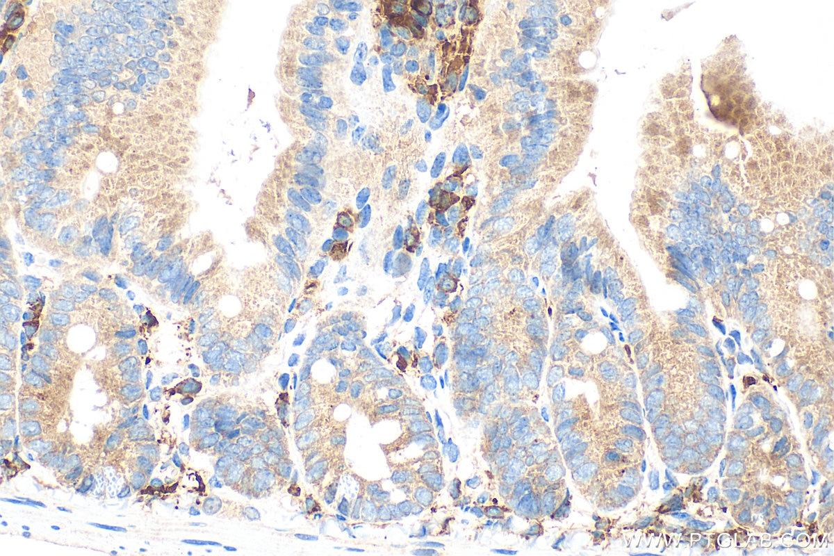 Immunohistochemistry (IHC) staining of mouse small intestine tissue using CLN3 Polyclonal antibody (20386-1-AP)
