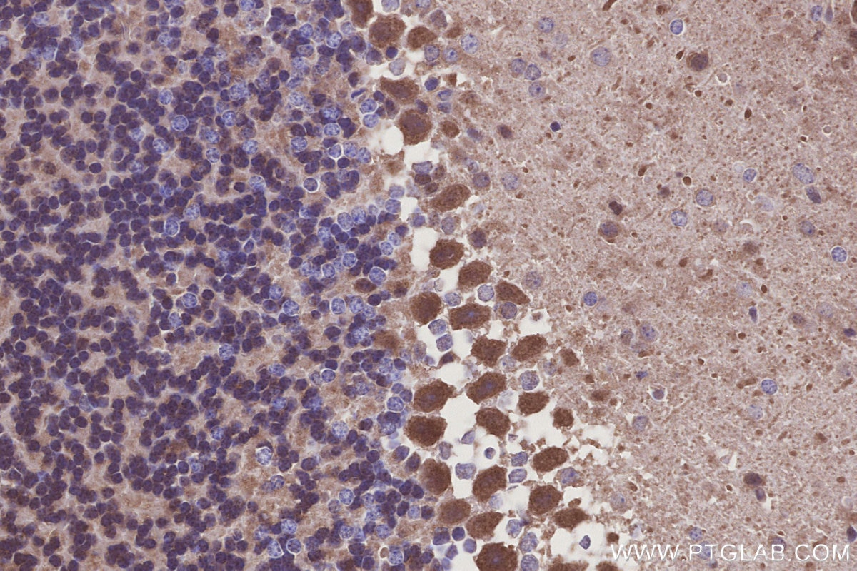 Immunohistochemistry (IHC) staining of mouse cerebellum tissue using CLN3 Polyclonal antibody (20386-1-AP)