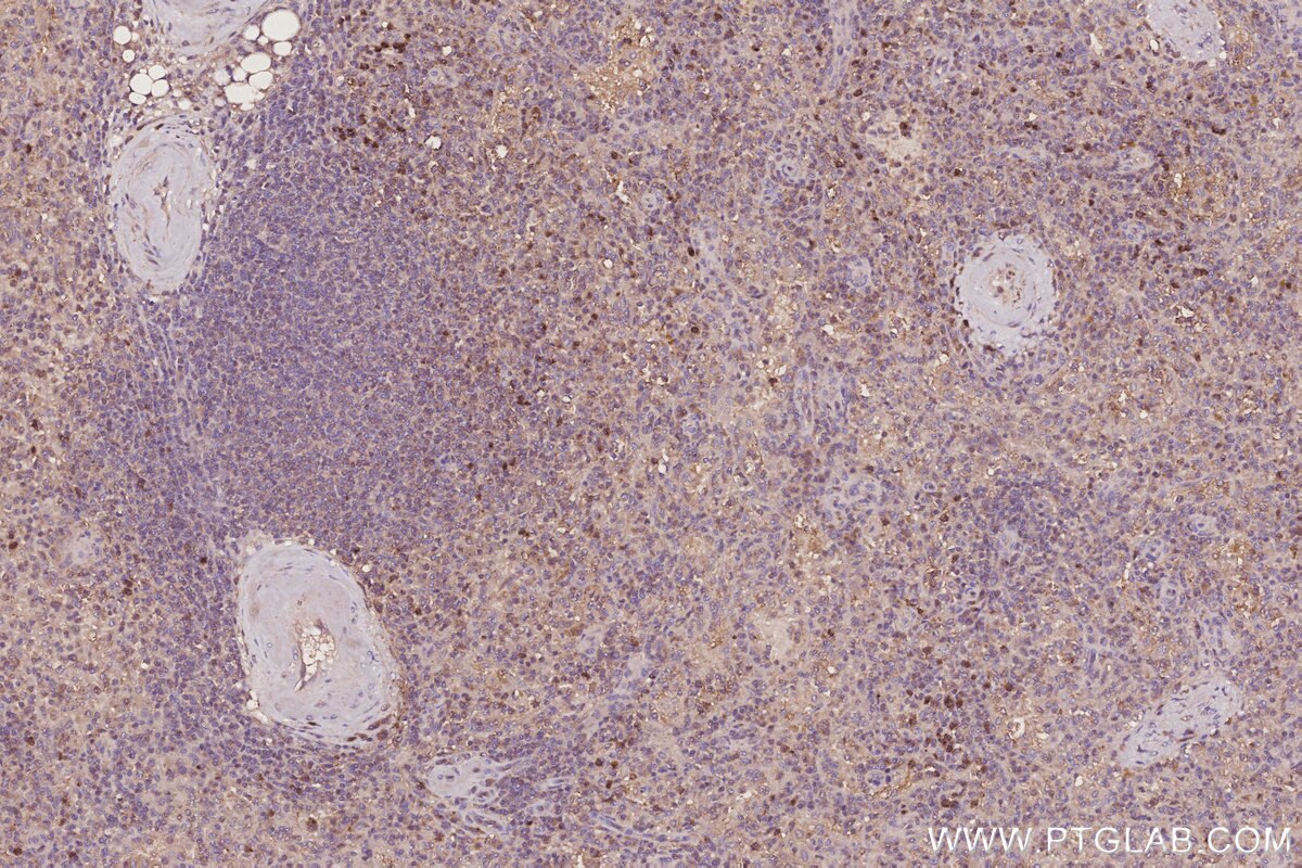 Immunohistochemistry (IHC) staining of human spleen tissue using CLN3 Polyclonal antibody (20386-1-AP)