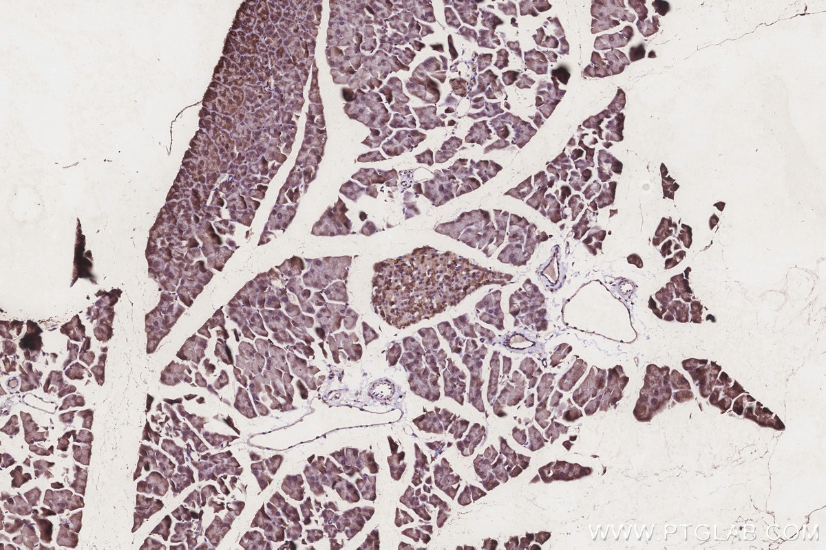 Immunohistochemistry (IHC) staining of mouse pancreas tissue using CLN3 Polyclonal antibody (20386-1-AP)