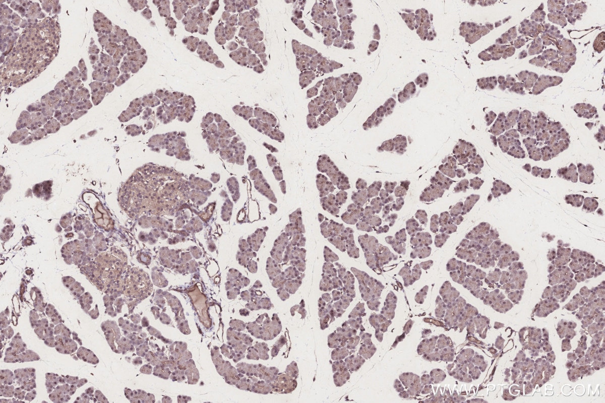 Immunohistochemistry (IHC) staining of rat pancreas tissue using CLN3 Polyclonal antibody (20386-1-AP)