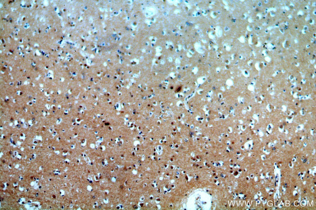 Immunohistochemistry (IHC) staining of human brain tissue using CLN3 Polyclonal antibody (20386-1-AP)