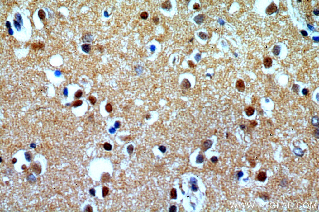 Immunohistochemistry (IHC) staining of human brain tissue using CLN3 Polyclonal antibody (20386-1-AP)