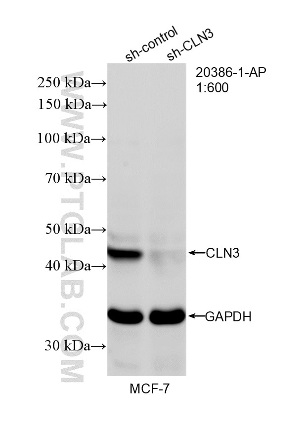 Western Blot (WB) analysis of MCF-7 cells using CLN3 Polyclonal antibody (20386-1-AP)