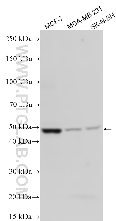 Western Blot (WB) analysis of various lysates using CLN3 Polyclonal antibody (20386-1-AP)