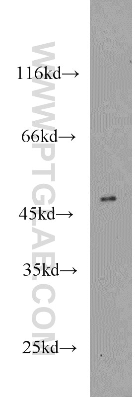 Western Blot (WB) analysis of SH-SY5Y cells using CLN3 Polyclonal antibody (20386-1-AP)