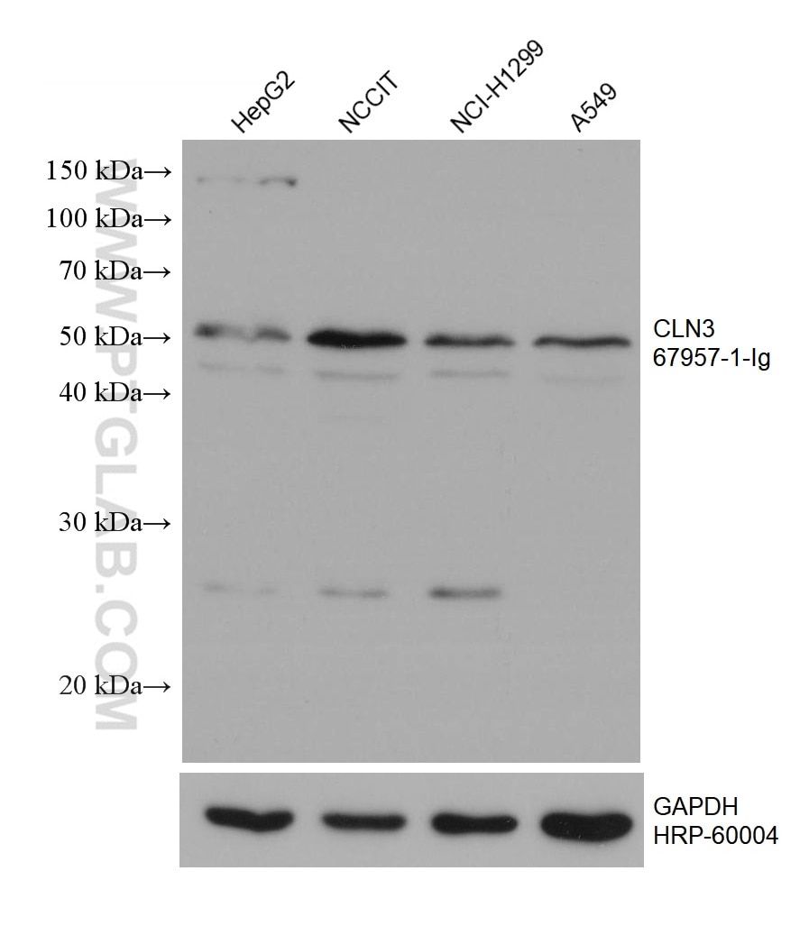 Western Blot (WB) analysis of various lysates using CLN3 Monoclonal antibody (67957-1-Ig)