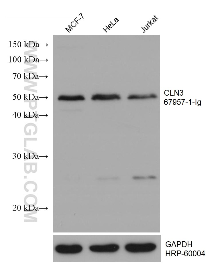 Western Blot (WB) analysis of various lysates using CLN3 Monoclonal antibody (67957-1-Ig)