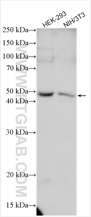 Western Blot (WB) analysis of various lysates using CLN5 Polyclonal antibody (24605-1-AP)