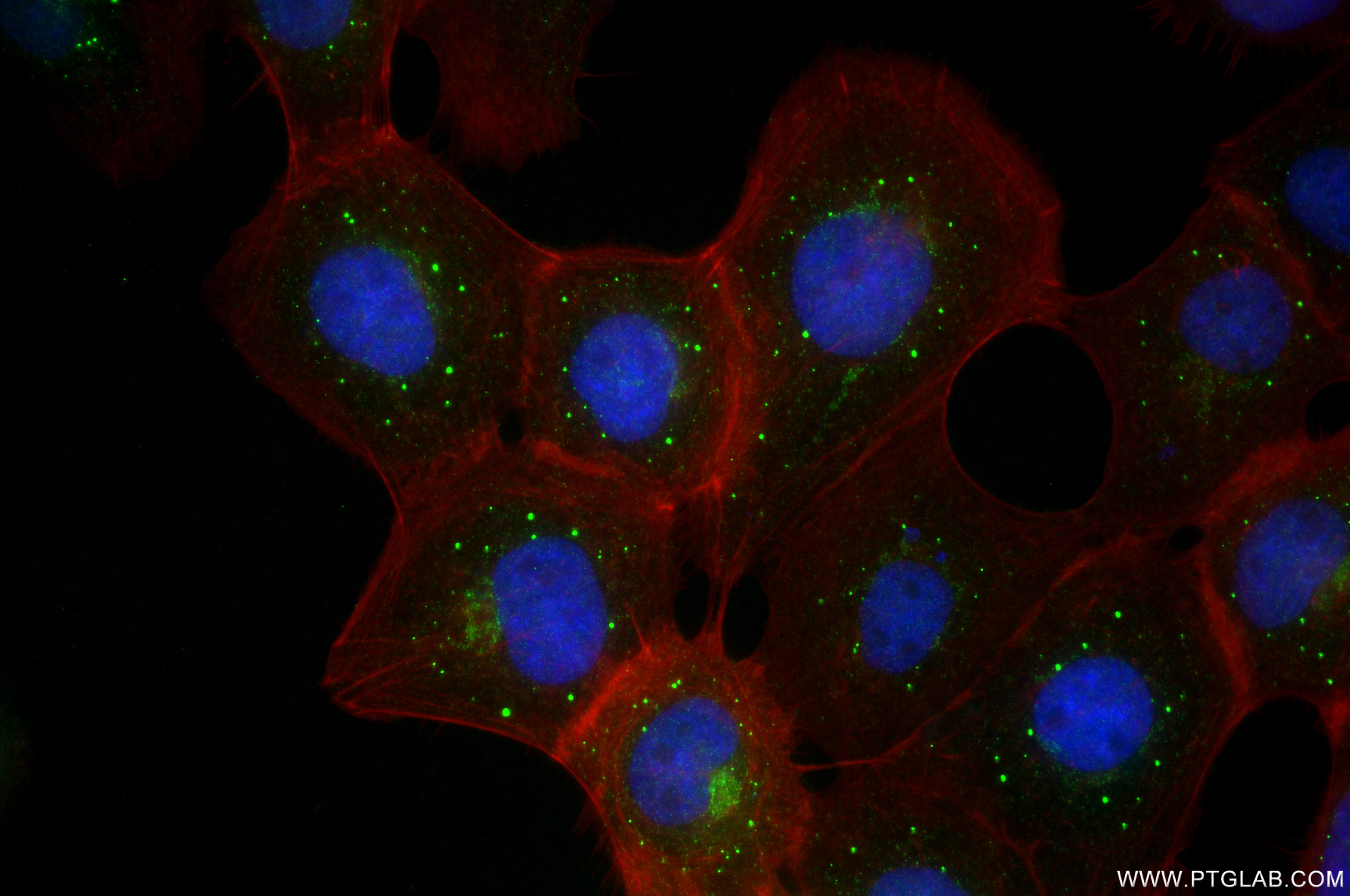 Immunofluorescence (IF) / fluorescent staining of A431 cells using CLN5 Recombinant antibody (85378-1-RR)