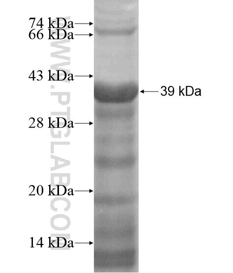 CLN5 fusion protein Ag19053 SDS-PAGE