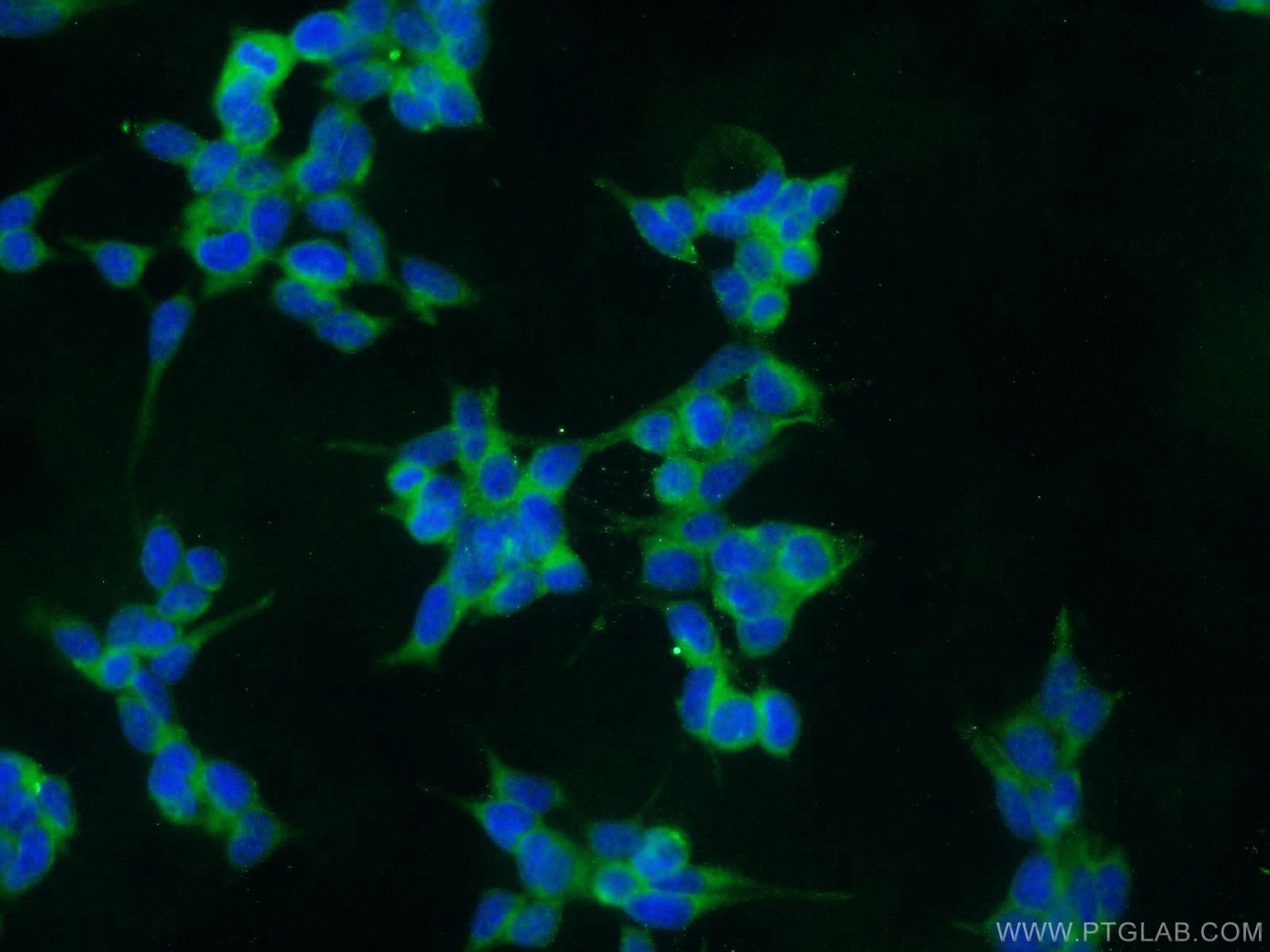Immunofluorescence (IF) / fluorescent staining of HEK-293 cells using CLN6 Polyclonal antibody (20315-1-AP)