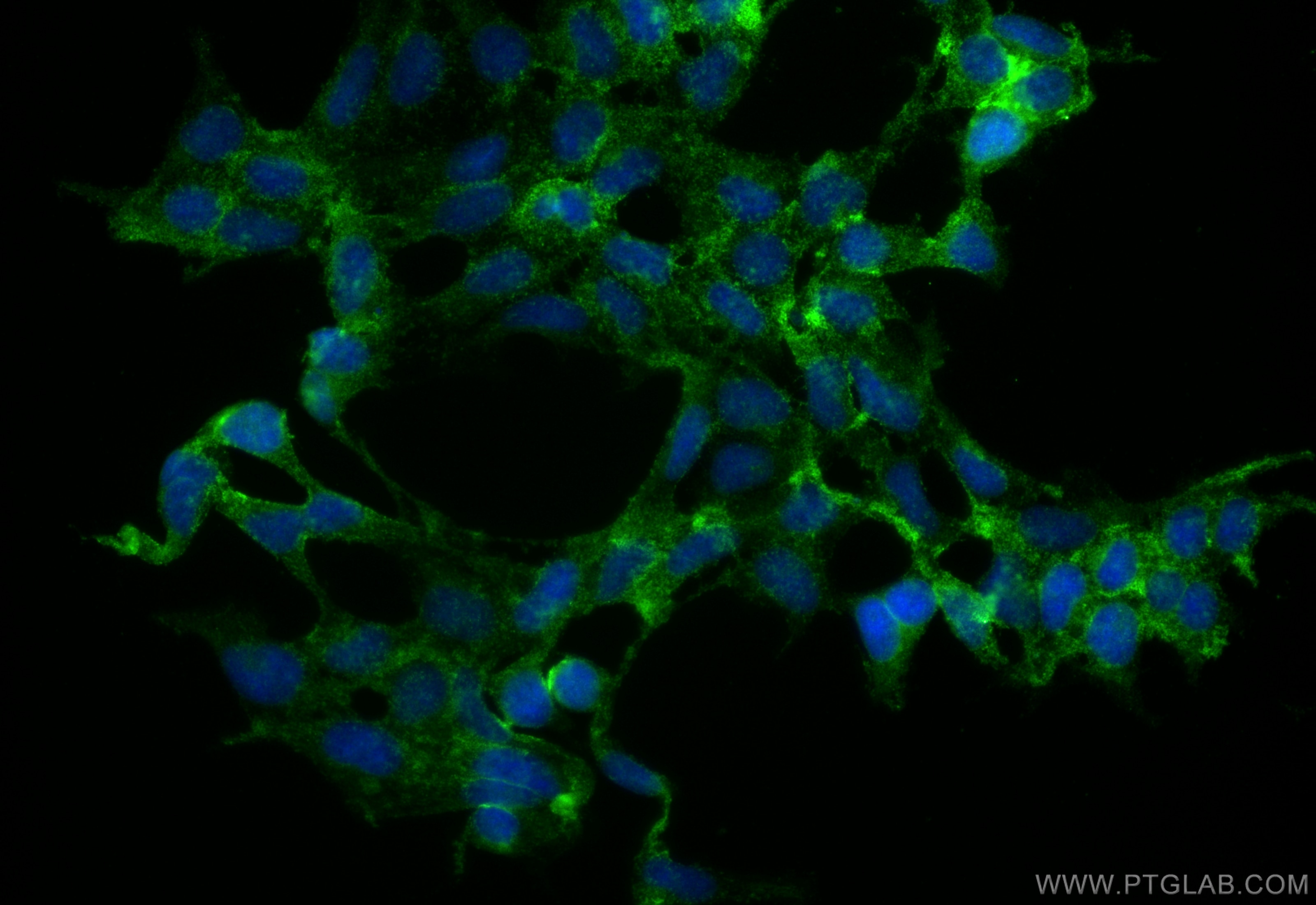 Immunofluorescent analysis of (4% PFA) fixed HEK-293 cells using CLN6 antibody (20315-1-AP) at dilution of 1:400 and CoraLite®488-Conjugated Goat Anti-Rabbit IgG(H+L) (SA00013-2). Immunofluorescence (IF) / fluorescent staining of HEK-293 cells using CLN6 Polyclonal antibody (20315-1-AP)