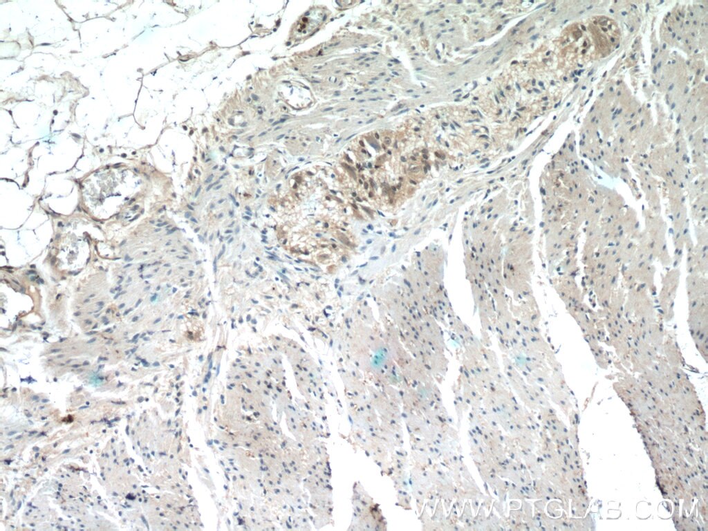 Immunohistochemistry (IHC) staining of human colon tissue using CLN6 Polyclonal antibody (20315-1-AP)