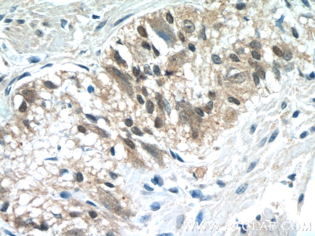 Immunohistochemistry (IHC) staining of human colon tissue using CLN6 Polyclonal antibody (20315-1-AP)