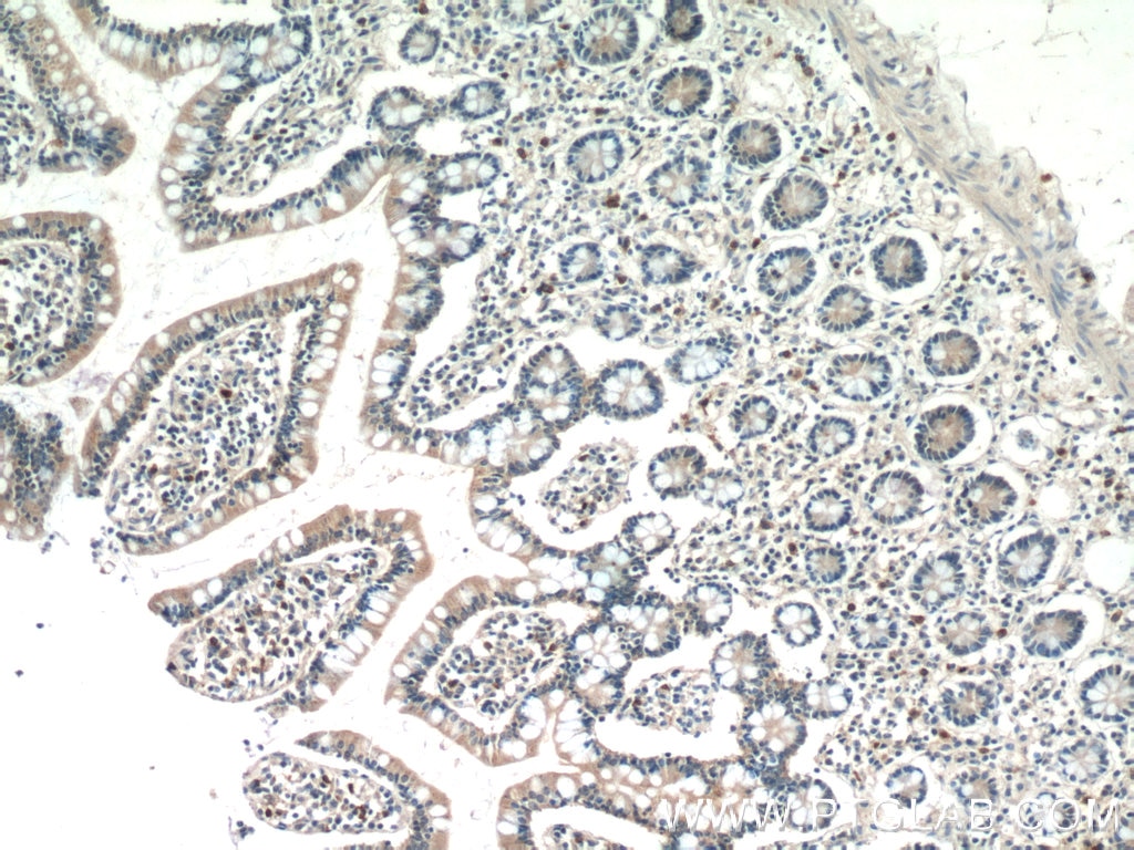 Immunohistochemistry (IHC) staining of human small intestine tissue using CLN6 Polyclonal antibody (20315-1-AP)