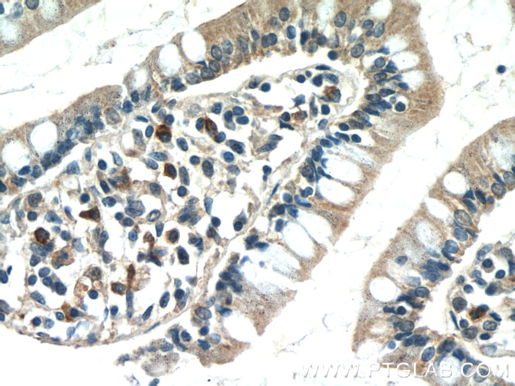 Immunohistochemistry (IHC) staining of human small intestine tissue using CLN6 Polyclonal antibody (20315-1-AP)