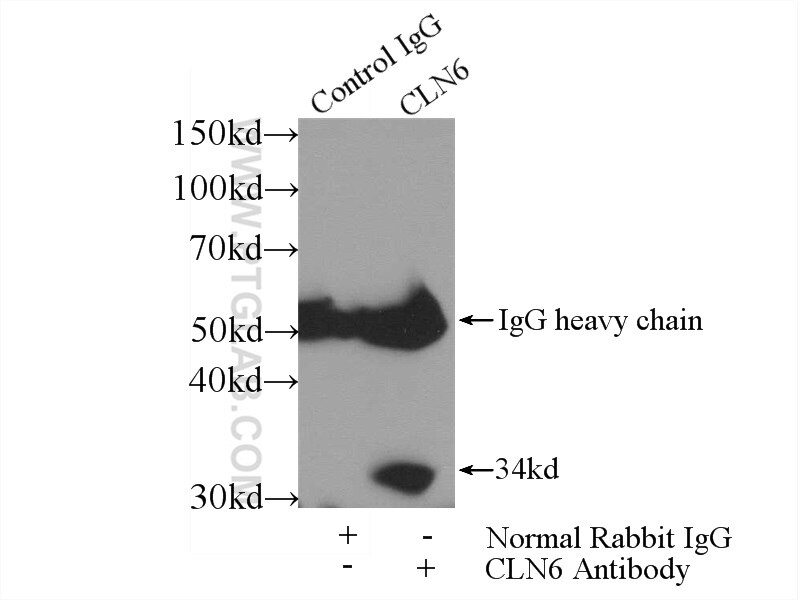 Immunoprecipitation (IP) experiment of HEK-293 cells using CLN6 Polyclonal antibody (20315-1-AP)