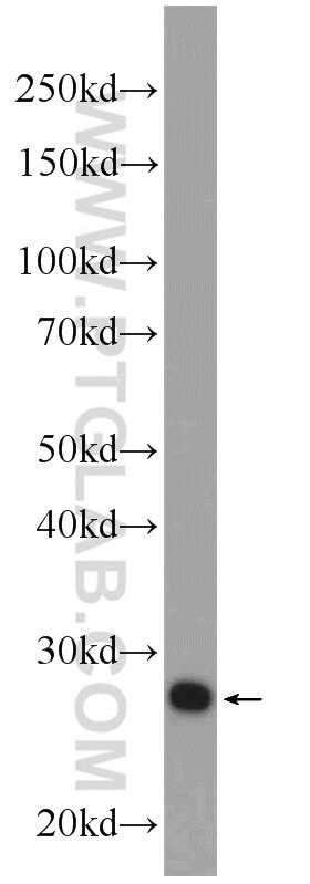 Western Blot (WB) analysis of HEK-293 cells using CLN6 Polyclonal antibody (20315-1-AP)