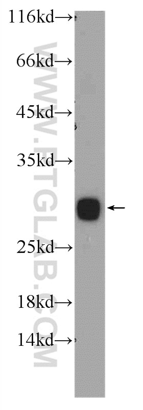 Western Blot (WB) analysis of SH-SY5Y cells using CLN6 Polyclonal antibody (20315-1-AP)