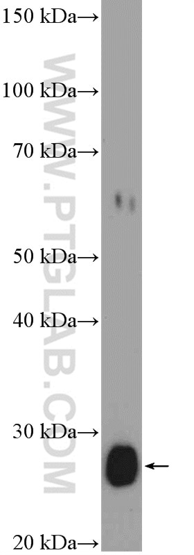 Western Blot (WB) analysis of SH-SY5Y cells using CLN6 Polyclonal antibody (20315-1-AP)