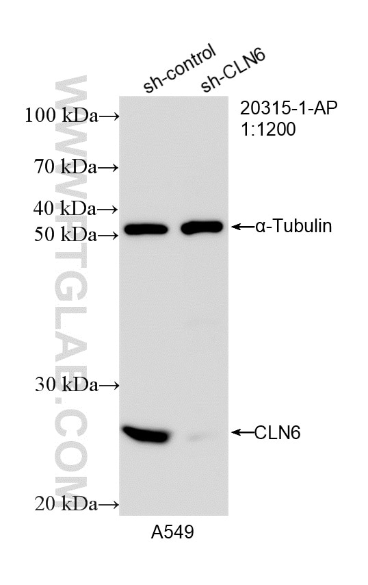 Western Blot (WB) analysis of HeLa cells using CLN6 Polyclonal antibody (20315-1-AP)
