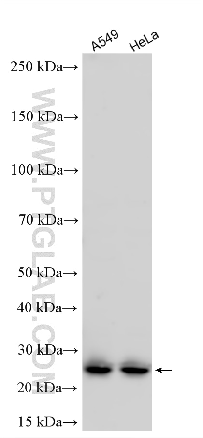 Western Blot (WB) analysis of various lysates using CLN6 Polyclonal antibody (20315-1-AP)