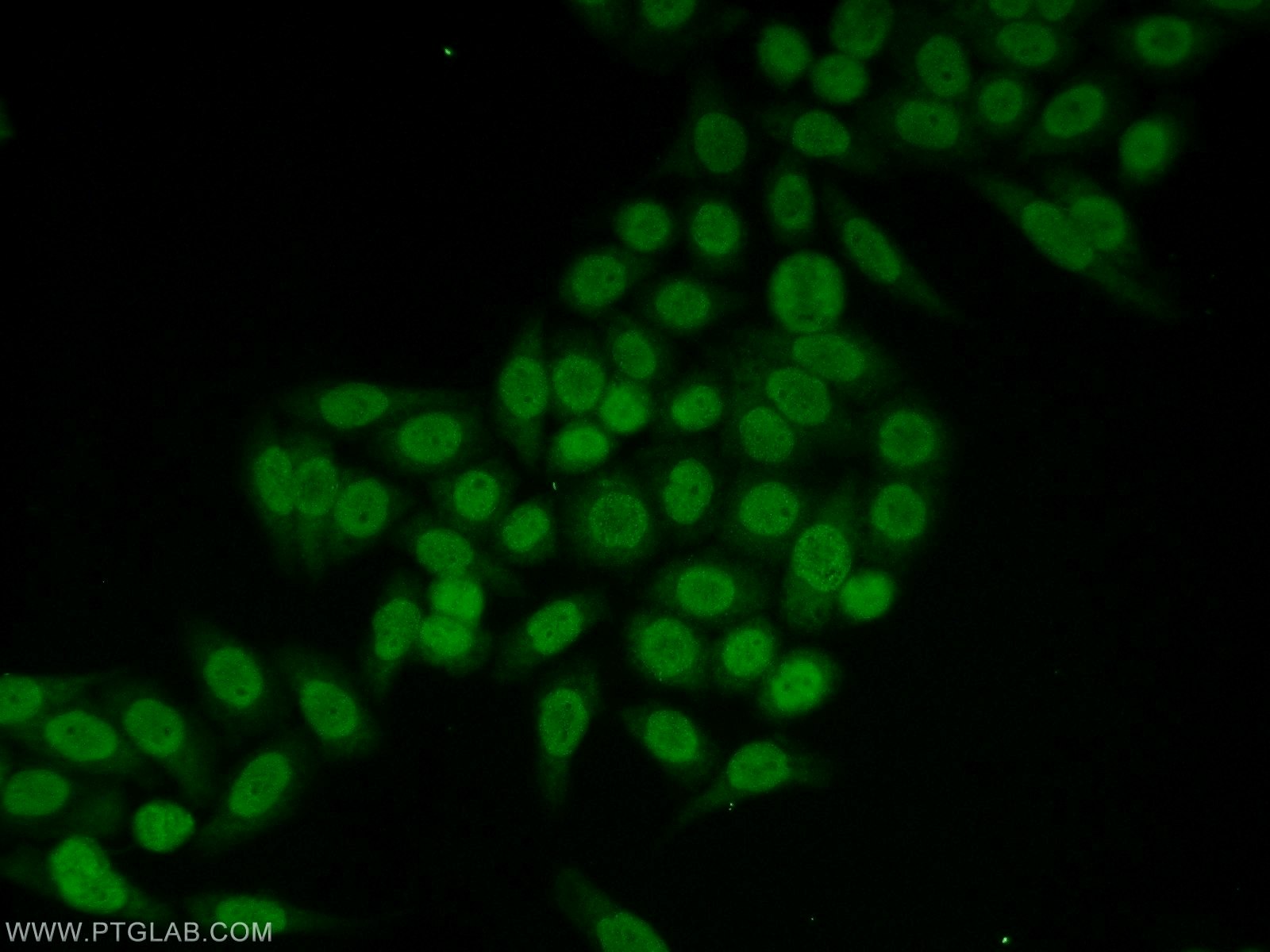 Immunofluorescence (IF) / fluorescent staining of HeLa cells using CLOCK Polyclonal antibody (18094-1-AP)