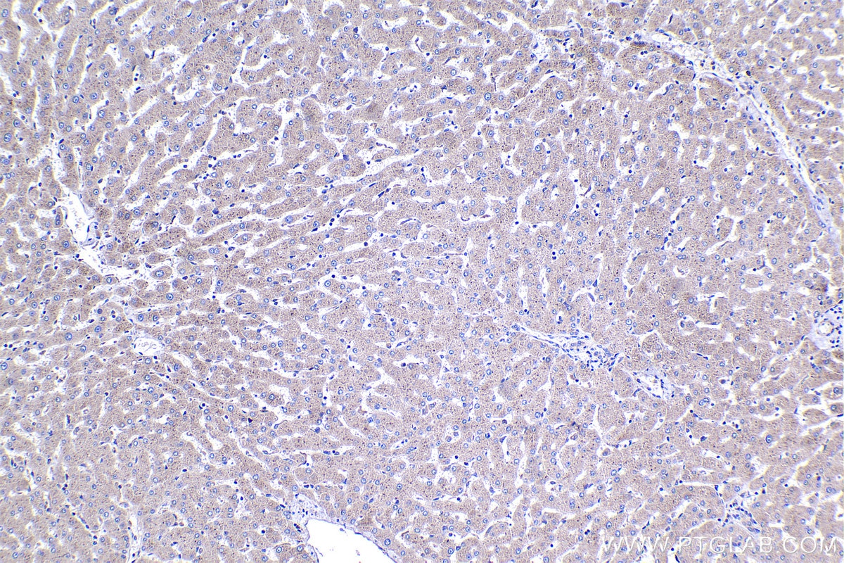 Immunohistochemistry (IHC) staining of human liver tissue using CLOCK Polyclonal antibody (18094-1-AP)