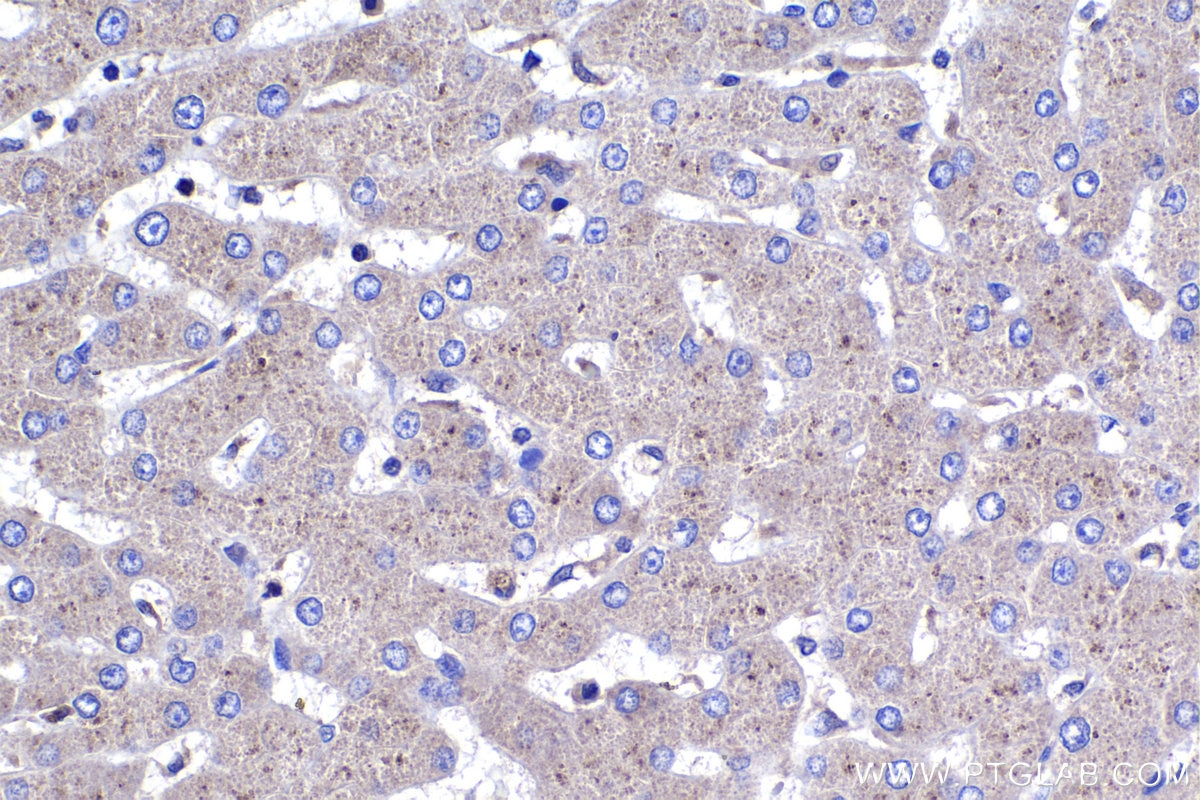 Immunohistochemistry (IHC) staining of human liver tissue using CLOCK Polyclonal antibody (18094-1-AP)