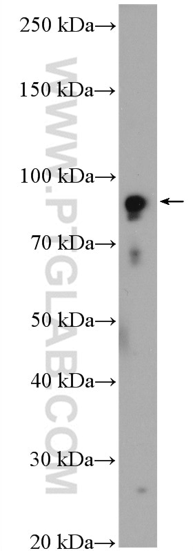 Western Blot (WB) analysis of HeLa cells using CLOCK Polyclonal antibody (18094-1-AP)