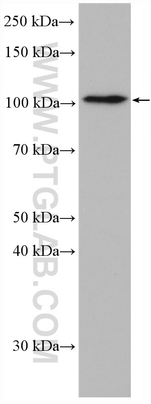 WB analysis of HeLa using 18094-1-AP