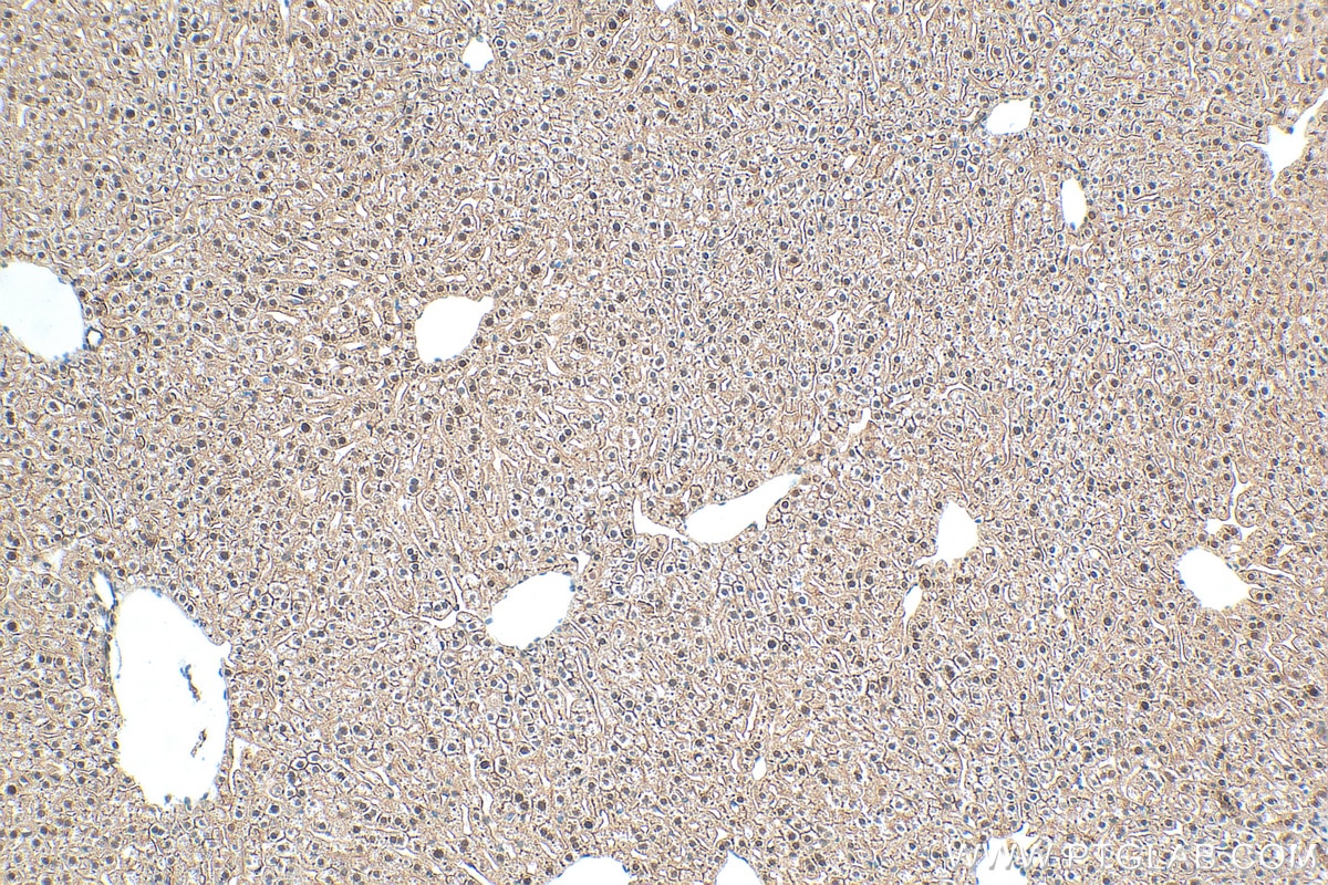 Immunohistochemistry (IHC) staining of mouse liver tissue using CLOCK Recombinant antibody (82829-1-RR)