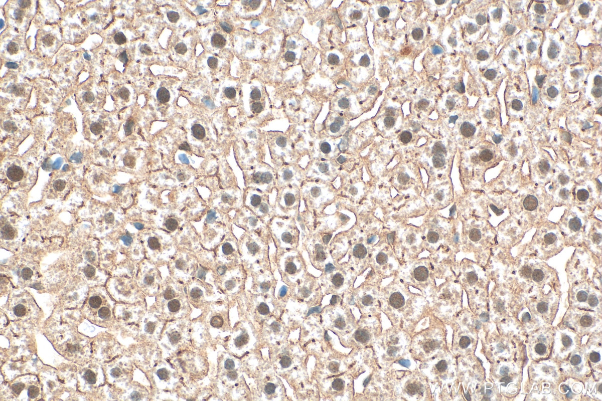 Immunohistochemistry (IHC) staining of mouse liver tissue using CLOCK Recombinant antibody (82829-1-RR)