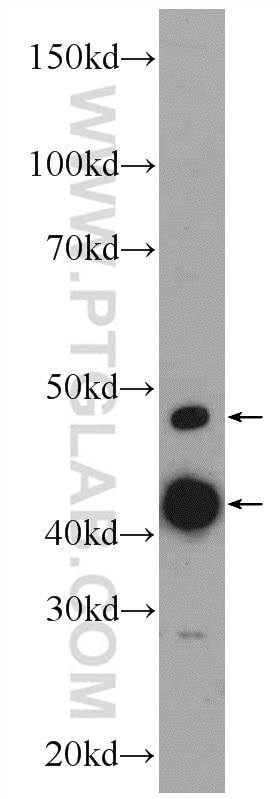 Western Blot (WB) analysis of HeLa cells using CLP1 Polyclonal antibody (14746-1-AP)