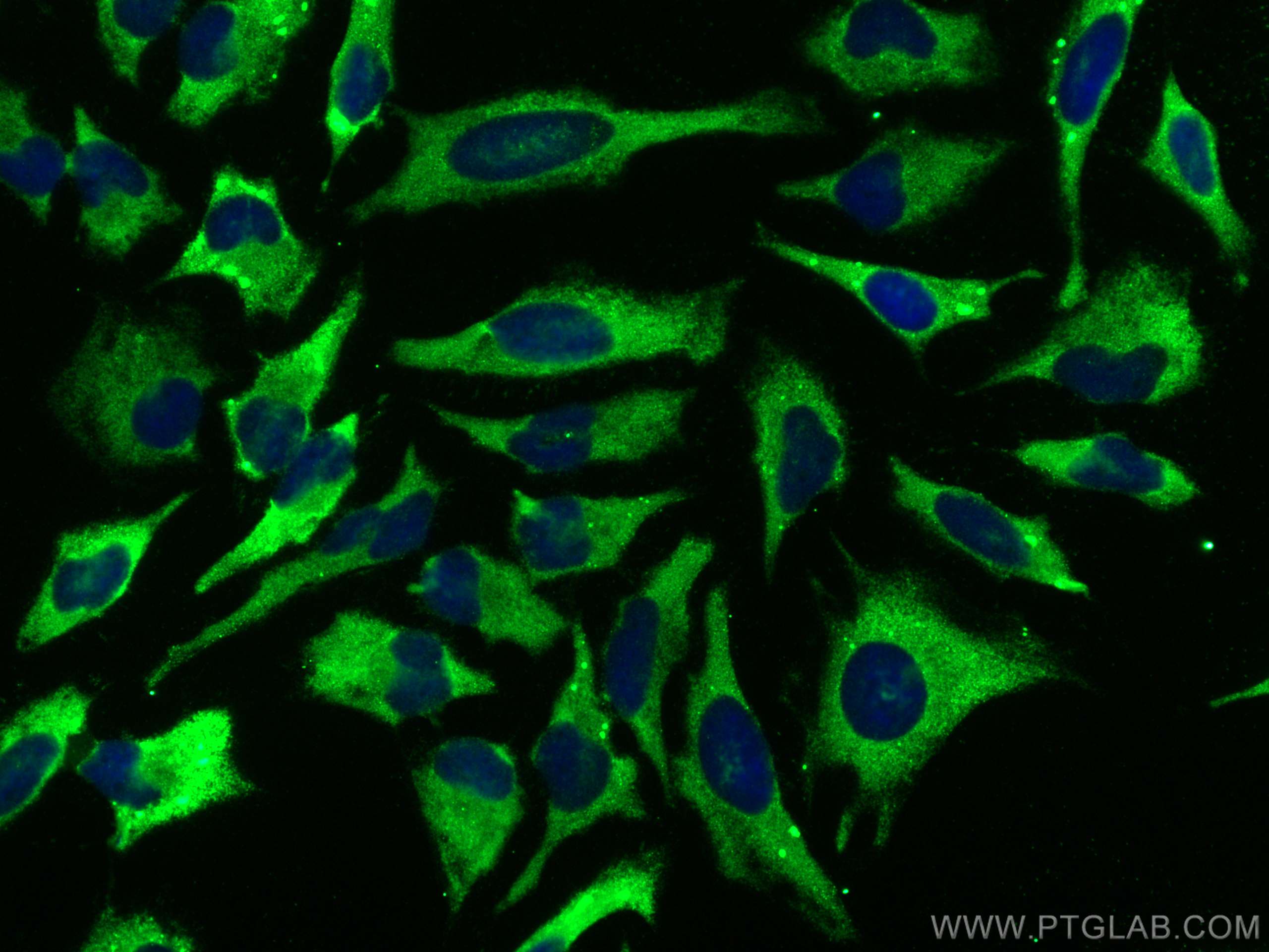 Immunofluorescence (IF) / fluorescent staining of HeLa cells using CLPB Polyclonal antibody (15743-1-AP)