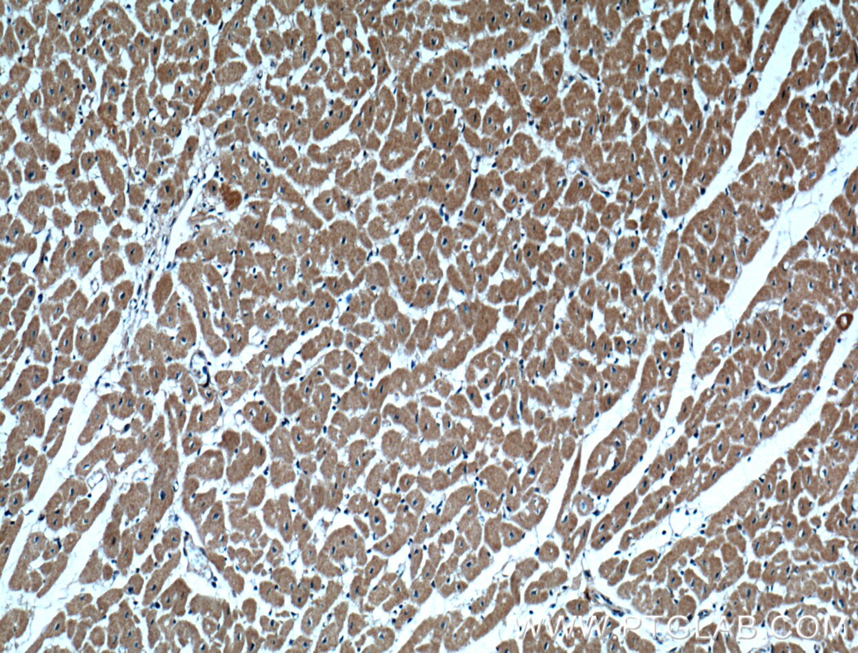 Immunohistochemistry (IHC) staining of human heart tissue using CLPB Polyclonal antibody (15743-1-AP)