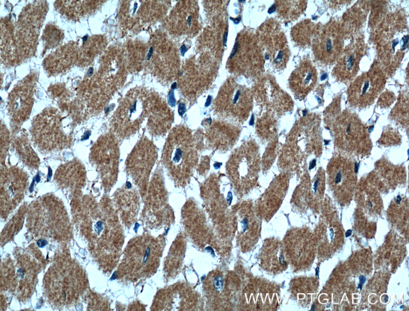 Immunohistochemistry (IHC) staining of human heart tissue using CLPB Polyclonal antibody (15743-1-AP)