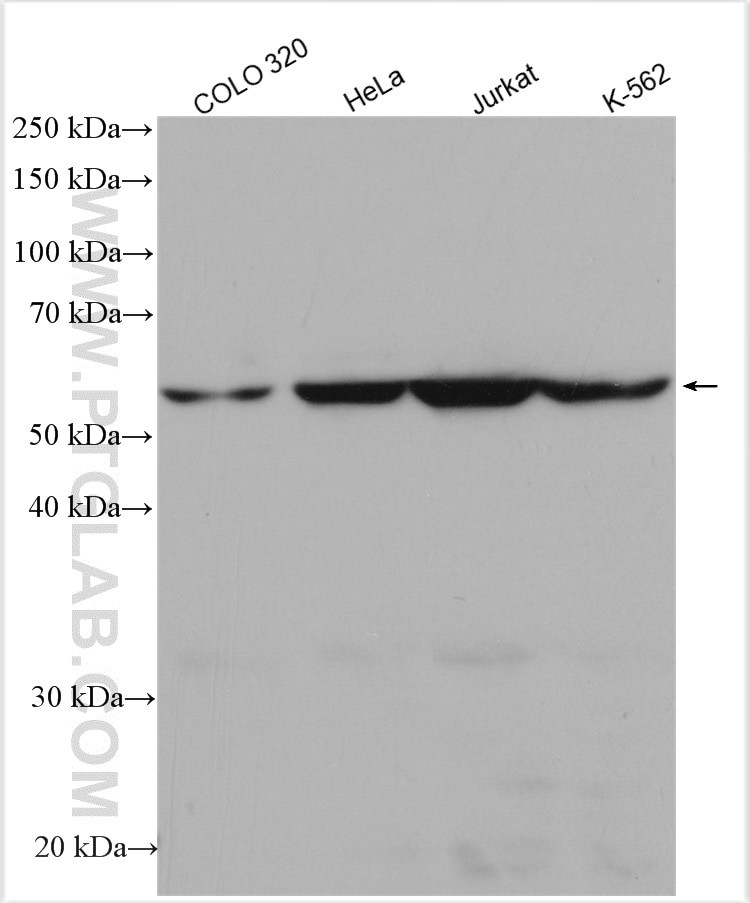 Western Blot (WB) analysis of various lysates using CLPB Polyclonal antibody (15743-1-AP)