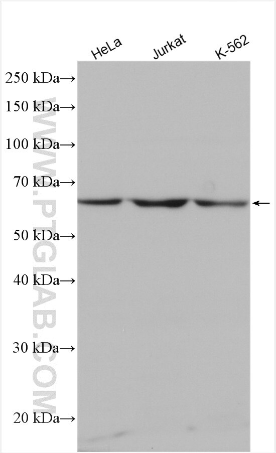 Western Blot (WB) analysis of various lysates using CLPB Polyclonal antibody (15743-1-AP)