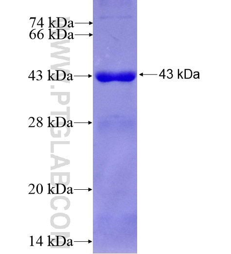 CLPB fusion protein Ag8165 SDS-PAGE