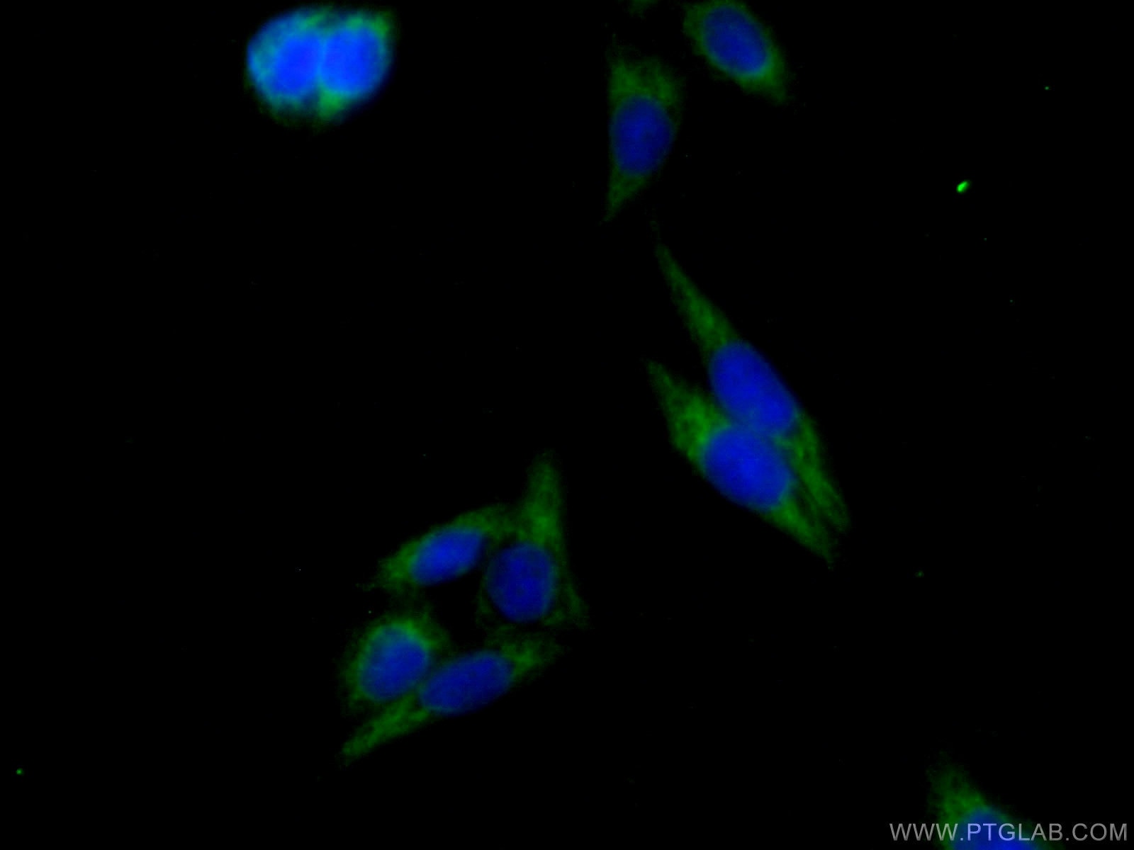 Immunofluorescence (IF) / fluorescent staining of HeLa cells using CLPP Polyclonal antibody (15698-1-AP)