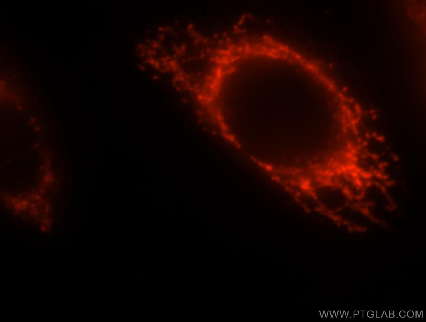 Immunofluorescence (IF) / fluorescent staining of HeLa cells using CLPP Polyclonal antibody (15698-1-AP)
