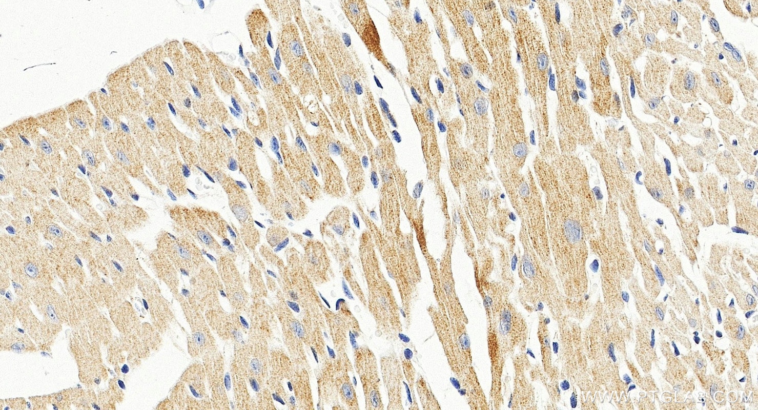 Immunohistochemistry (IHC) staining of mouse heart tissue using CLPP Polyclonal antibody (15698-1-AP)