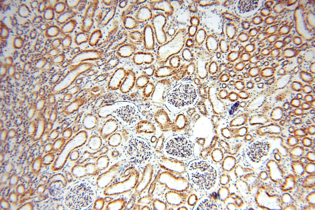 Immunohistochemistry (IHC) staining of human kidney tissue using CLPP Polyclonal antibody (15698-1-AP)