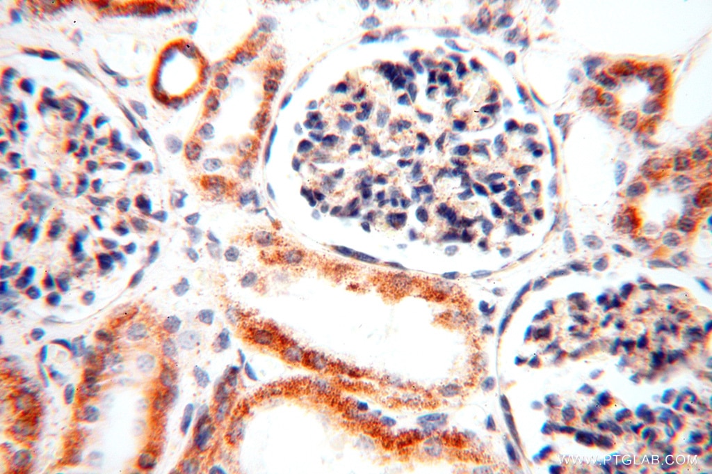 Immunohistochemistry (IHC) staining of human kidney tissue using CLPP Polyclonal antibody (15698-1-AP)
