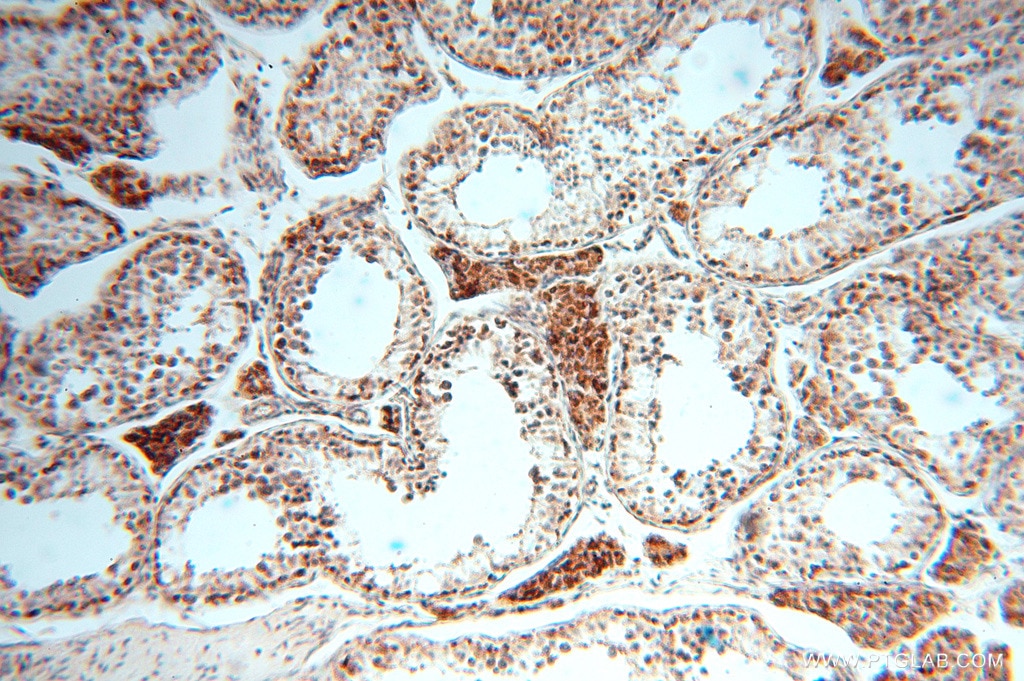 Immunohistochemistry (IHC) staining of human testis tissue using CLPP Polyclonal antibody (15698-1-AP)