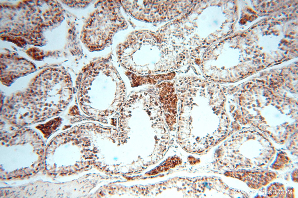 IHC staining of human testis using 15698-1-AP