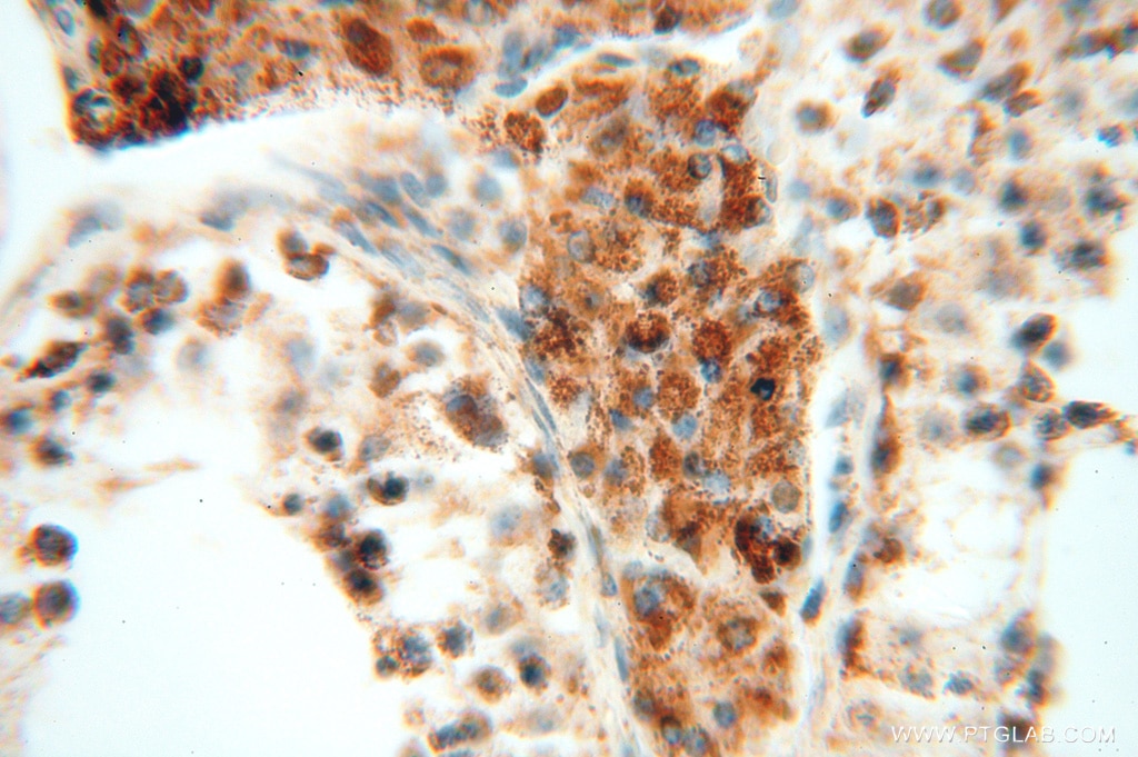 IHC staining of human testis using 15698-1-AP